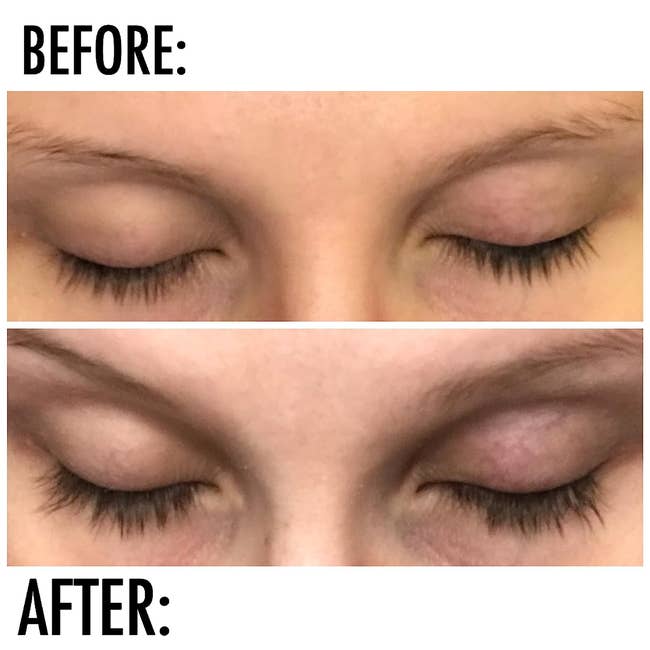 top: reviewer's before photo of short, thin lashes / bottom: after photo of same reviewer's longer, fuller lashes after using the serum