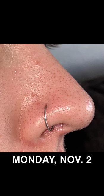 Reviewer before using Paula's Choice BHA serum