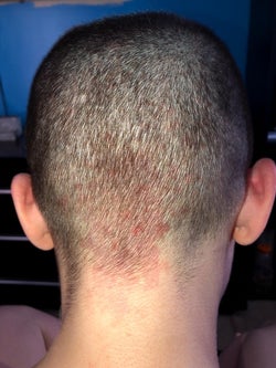 Back of reviewer's head before using scalp massager