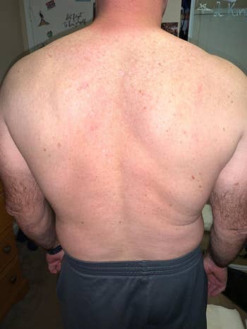 after image of the same reviewer's back no hair-free and smooth