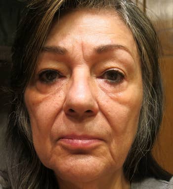 reviewer before photo showing under eye bags