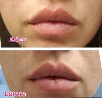 Close-up of a person's lips before and after using a lip-enhancing product, indicating increased fullness