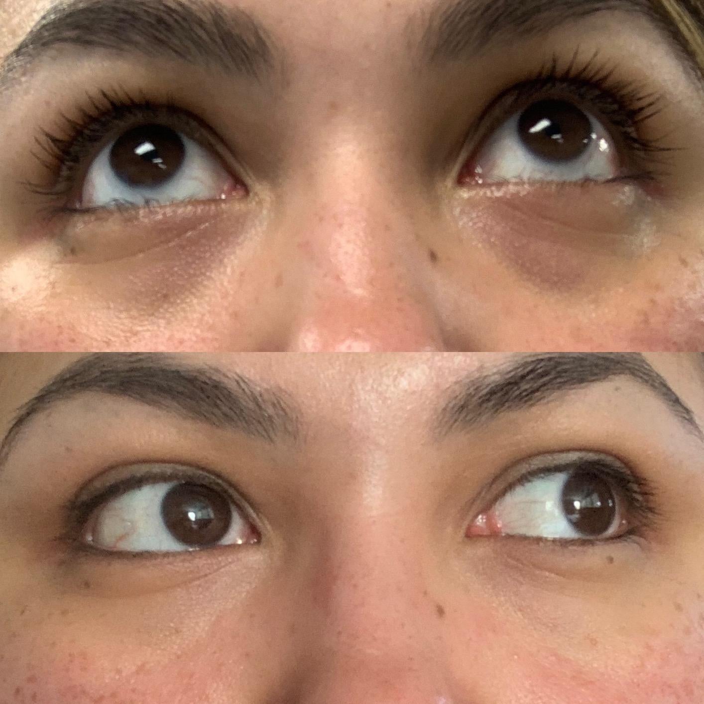 Reviewer before photo showing dark under-eye circles above an after photo showing brighter under-eye areas