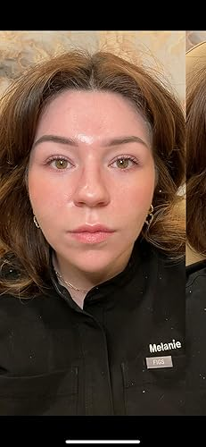 A person's nether  eyes aft  utilizing merchandise  for good  lines and discoloration
