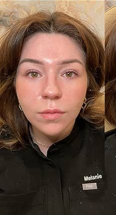 A person's nether eyes aft utilizing merchandise for good lines and discoloration