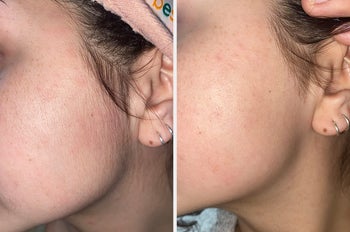 reviewer showing hair on their cheek, and same reviewer showing cheek hairless and smooth after using the touch-up tool 