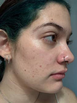 Close-up of the same reviewer showing improved skin texture