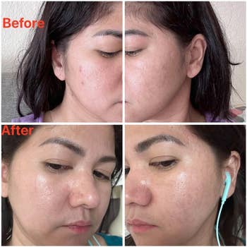 Before and after images of reviewer using peel off mask