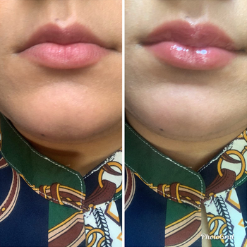 reviewer's lips before and after using lip plumper