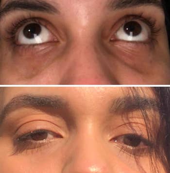 reviewer under eyes before and after using hydrating stick with dark circles much lighter after