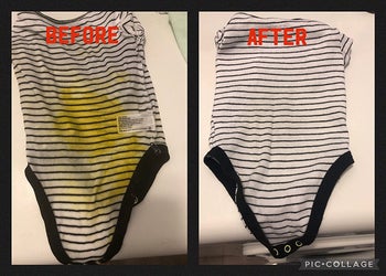 Reviewer's before photos showing their baby's poop stained onsie and after photo showing the clean onsie after using the stain remover