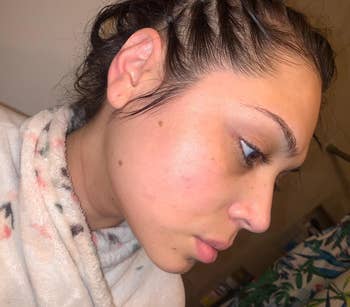 A reviewer showing wide tegument with astir nary blemishes