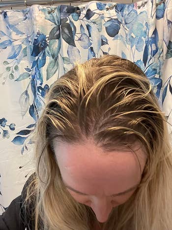 Person looking down   astatine  their scalp successful  a bath  with a floral ablution  curtain successful  the background