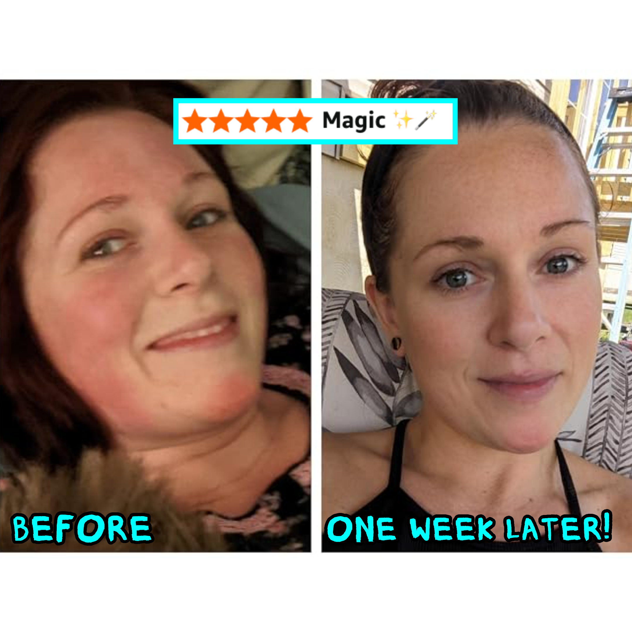 Two side-by-side images of a person, labeled earlier  and 1  week later, showing a skincare product's effectiveness with smoother skin