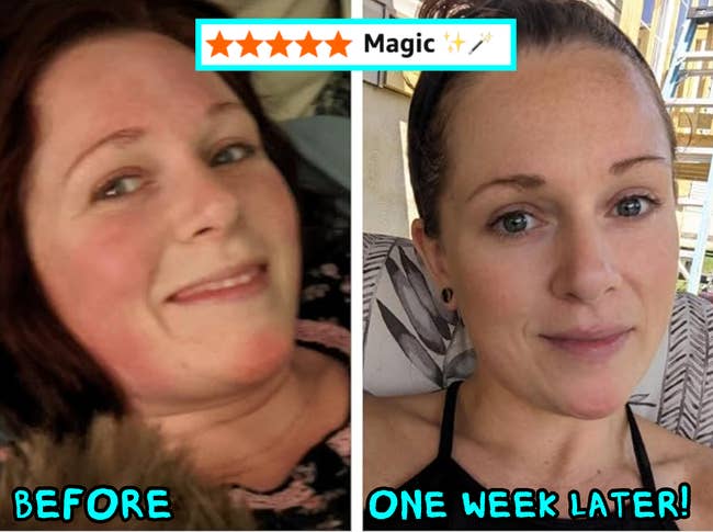 Two side-by-side images of a person, labeled earlier and 1 week later, showing a skincare product's effectiveness with smoother skin