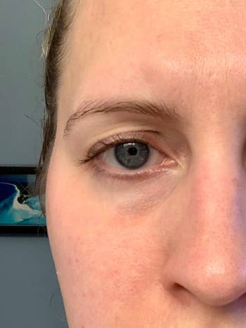 after photo of the same reviewer's under eye area without redness after using the eye cream