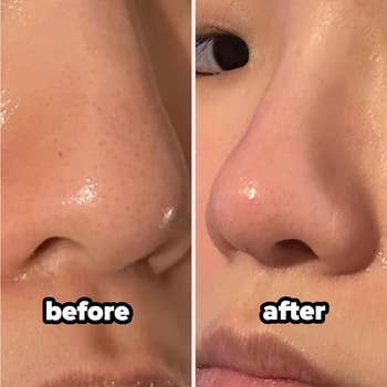 Close-up side-by-side images of a person's nose, labeled