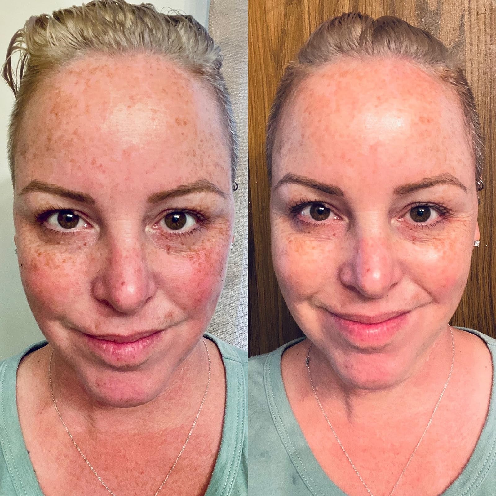 A reviewer's before and after photo with much smoother, lifted, and brightened skin after using the mask