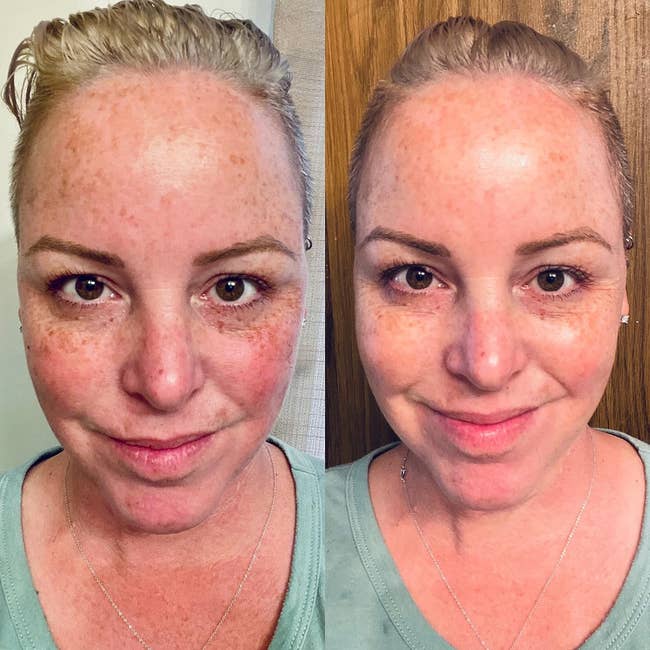 A reviewer's before and after photo with much smoother, lifted, and brightened skin after using the mask