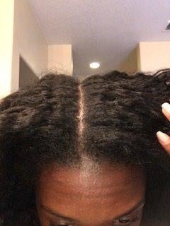 the same reviewer with no visible scalp flakes