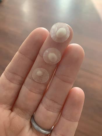 reviewer pic of hand holding three circular Mighty Patches filled with puss from pimples