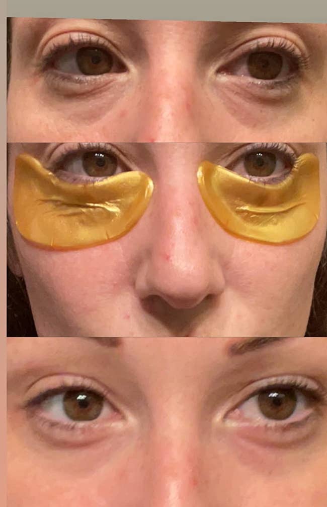 An image split into three with a reviewer before eye masks, wearing eye masks, and after the eye masks. Under eyes look lighter and less puffy 