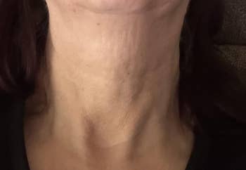 Close-up of a person's cervix  showing tegument  texture and contours