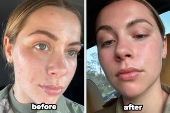 Close-up of a person's face showing skincare results, with a