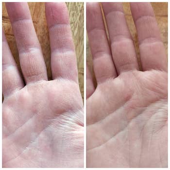 reviewer's dry hand before using the cream and soft, moisturized hand 2 days after using it