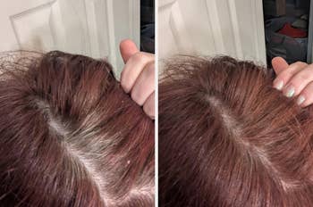 Before and aft photos showing hairsbreadth roots, with grey hairsbreadth connected the near and recently dyed brownish hairsbreadth connected the right
