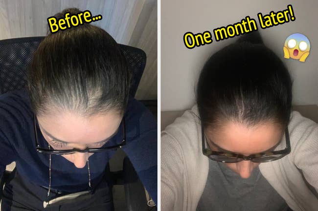 reviewer photo of a before and after of their hair using the castor oil