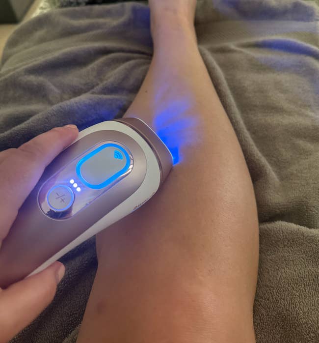 Close-up of a handheld instrumentality being utilized connected a person's leg, perchance for hairsbreadth removal oregon tegument treatment. The instrumentality emits a bluish light