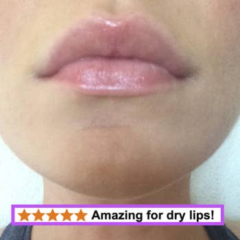 Close-up of shiny lips with a five-star standing  and substance   saying 