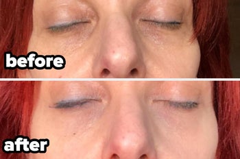 reviewer photo showing under eyes before and after using cream, with brighter skin and visibly reduced dark circles