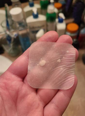 A hand holding a large patch that has multiple white spots showing what came out of their pimples