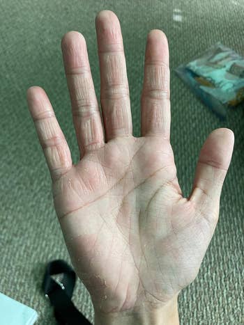 setelah gambar tangan yang sama sekarang halus dan terhidrasi