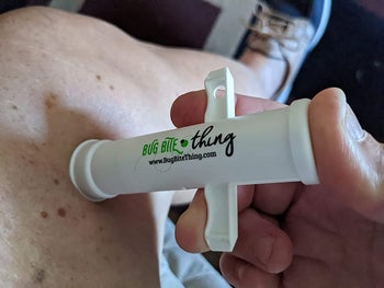 a reviewer using the bug bite thing on their thigh