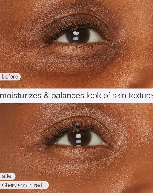 Close-up of tegument earlier and aft moisturizing cream, showing smoother texture. Text highlights