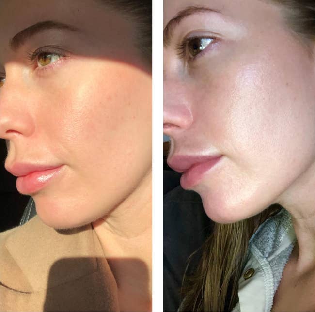 Close-up side-by-side comparison of a reviewer's face, showcasing changes in skin texture and hydration