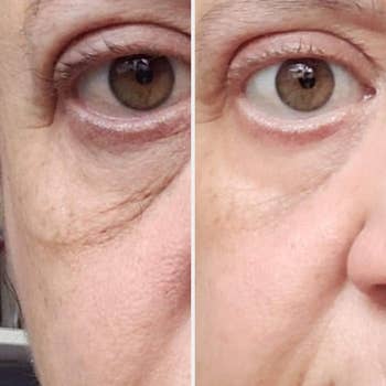 Reviewer earlier  and aft  showing the pick  tightened and brightened their under-eye area