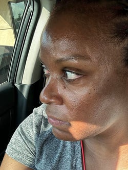 before photo of a reviewer with very shiny and oily-looking skin