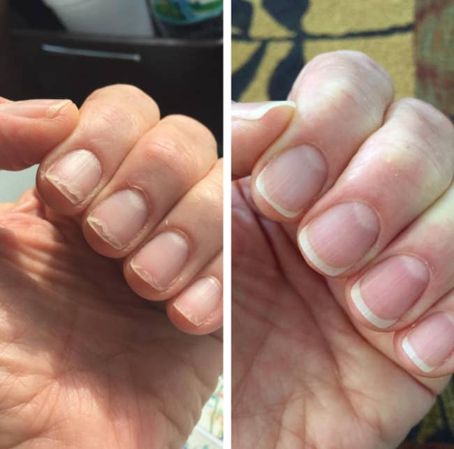 reviewer before and after with chipped nails looking healthy and strong after using product 