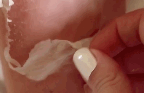 Close-up of a hand with manicured nails peeling off a dried white face mask from the skin