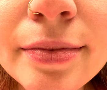 Close-up of a person's lips and nose, showcasing chapped lips