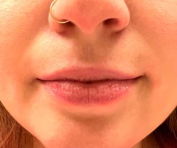 Close-up of a person's lips and nose, showcasing chapped lips