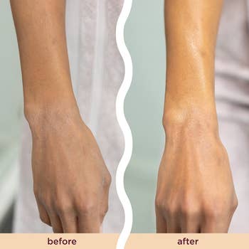 models dry arm before then moisturized arm after
