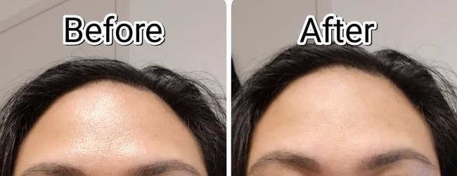 a reviewer before and after photo showing the face roller helped with their oily skin