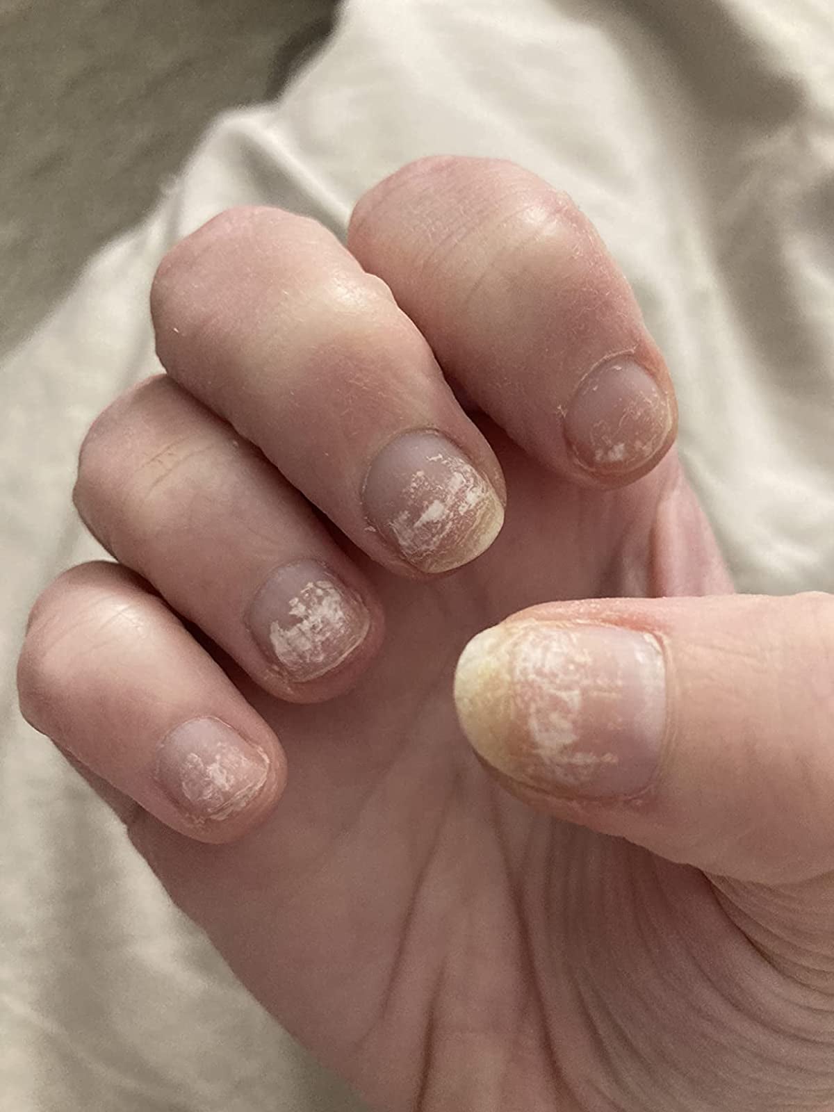 19 Products To Help Stop Nail Biting 19 Products To Help Stop Nail Biting