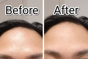 Reviewer before and after of their oily forehead and then dry after using the stick