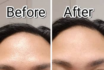 Reviewer before and after of their oily forehead and then dry after using the stick